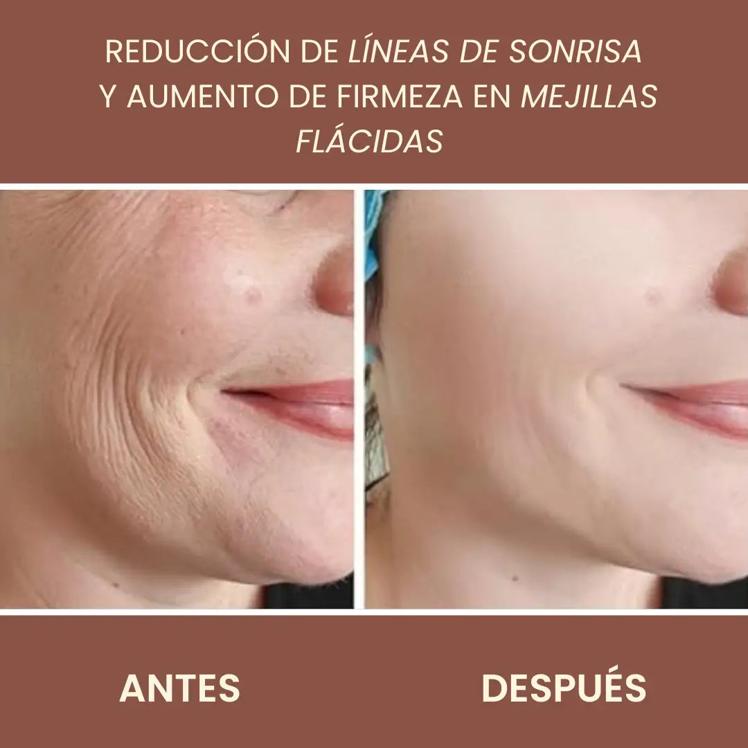 Kahi | Reduce Líneas de Expresión en 14 Días con el Bálsamo #1 de las Series Coreanas